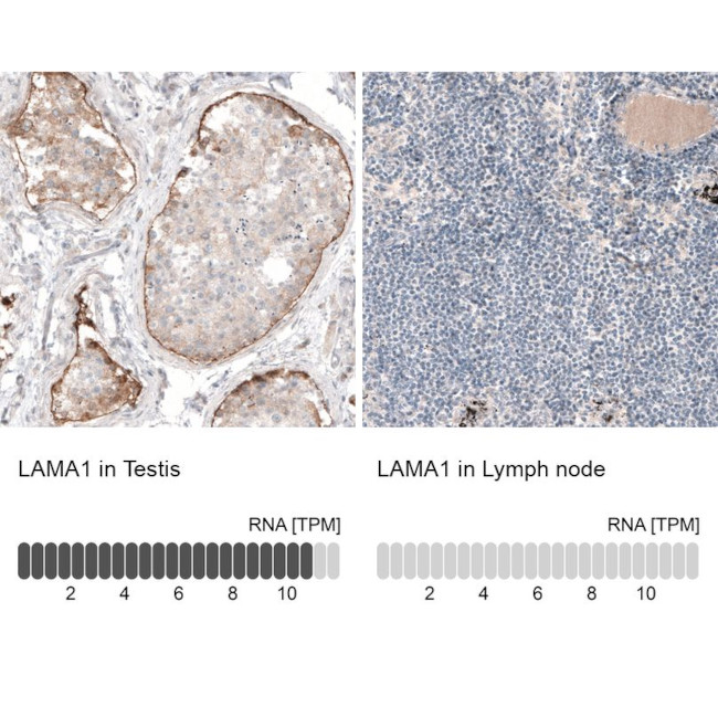 Laminin alpha-1 Antibody