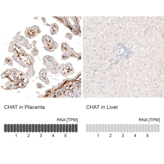 ChAT Antibody