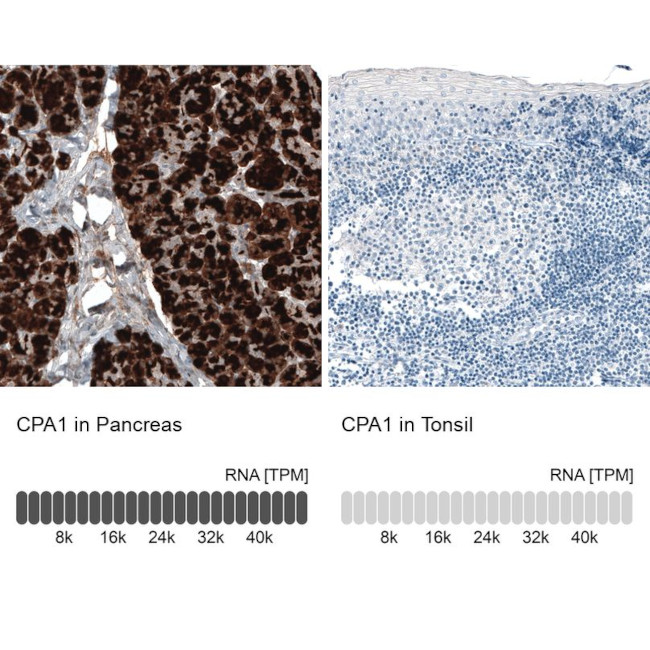 Carboxypeptidase A1 Antibody