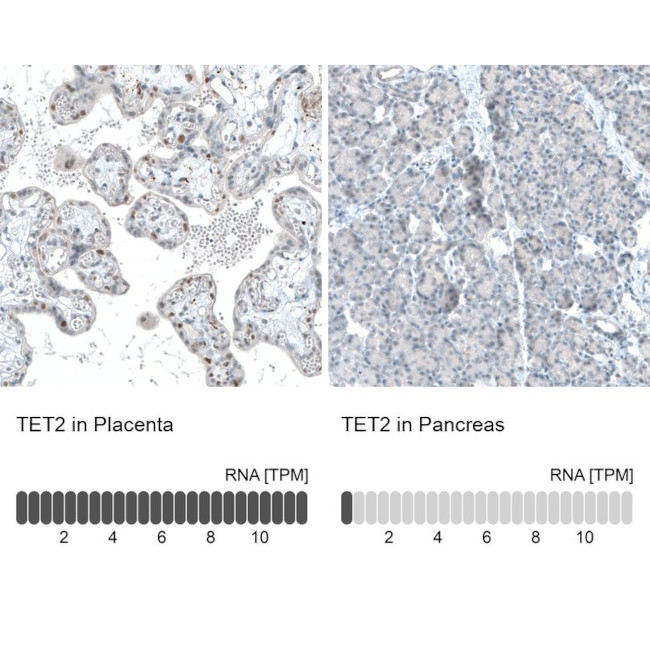 TET2 Antibody