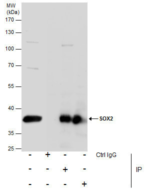 SOX2 Antibody in Immunoprecipitation (IP)