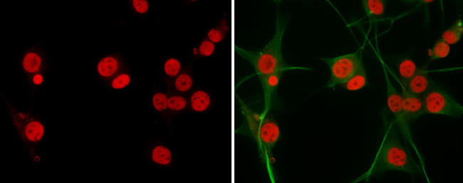 SOX2 Antibody in Immunocytochemistry (ICC/IF)