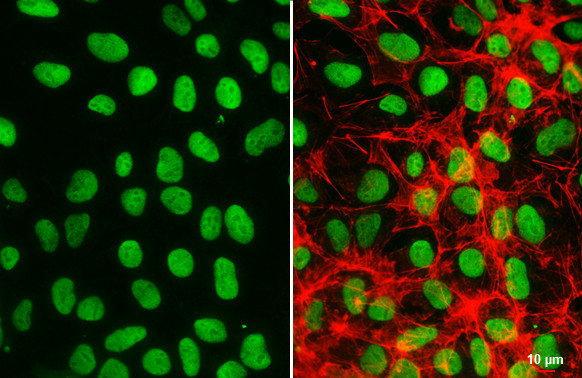 OCT4 Antibody in Immunocytochemistry (ICC/IF)