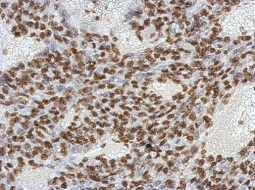 OCT4 Antibody in Immunohistochemistry (Paraffin) (IHC (P))