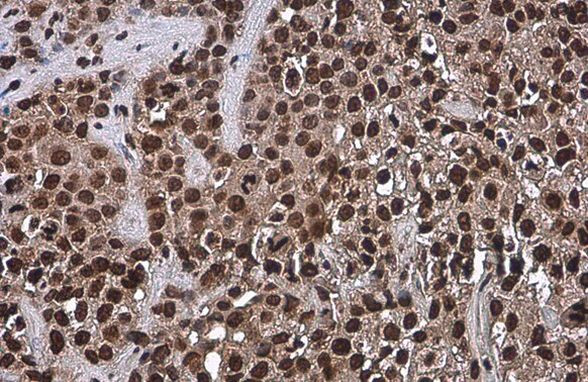 OCT4 Antibody in Immunohistochemistry (Paraffin) (IHC (P))