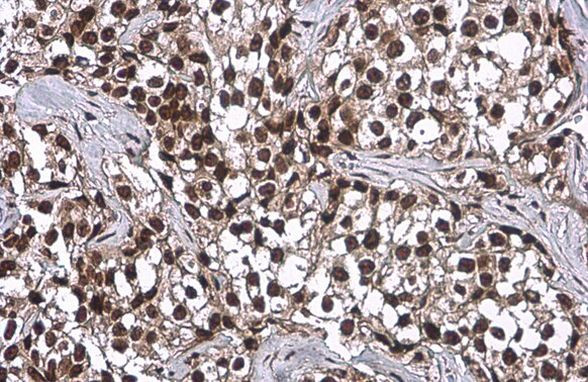 OCT4 Antibody in Immunohistochemistry (Paraffin) (IHC (P))