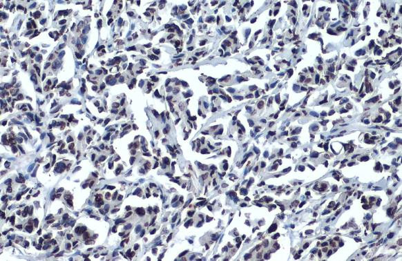 OCT4 Antibody in Immunohistochemistry (Paraffin) (IHC (P))