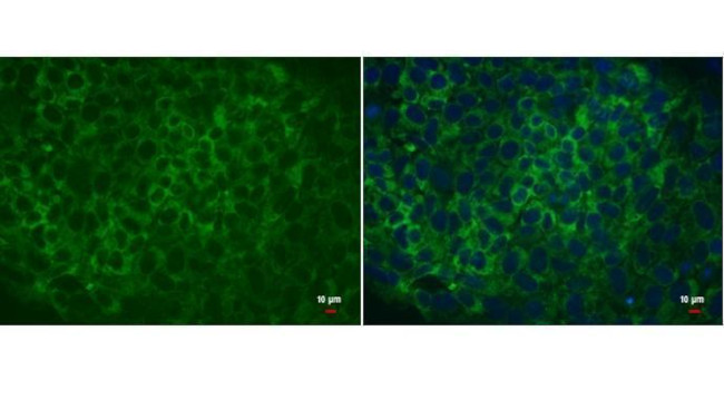 LIN28A Antibody in Immunocytochemistry (ICC/IF)