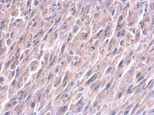 LIN28A Antibody in Immunohistochemistry (Paraffin) (IHC (P))