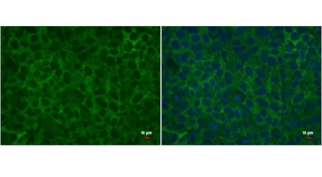 LIN28A Antibody in Immunocytochemistry (ICC/IF)