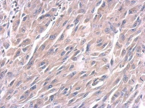 LIN28A Antibody in Immunohistochemistry (Paraffin) (IHC (P))