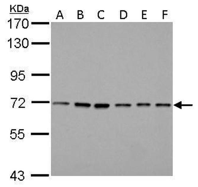 PRMT5 Antibody in Western Blot (WB)