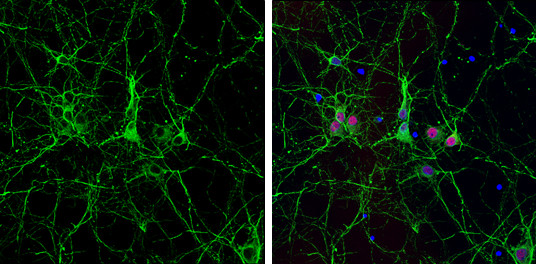 alpha Tubulin Antibody in Immunocytochemistry (ICC/IF)