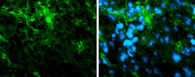 alpha Tubulin Antibody in Immunocytochemistry (ICC/IF)