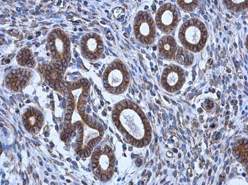 alpha Tubulin Antibody in Immunohistochemistry (Paraffin) (IHC (P))