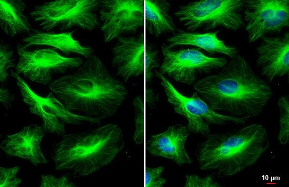 alpha Tubulin Antibody in Immunocytochemistry (ICC/IF)