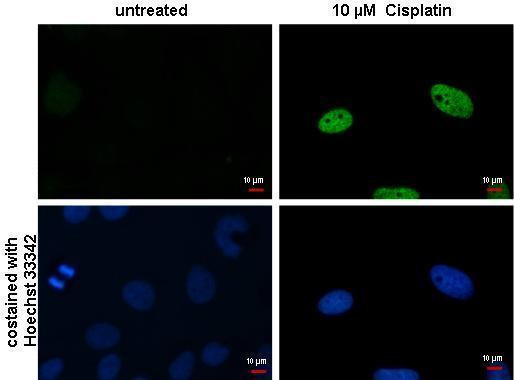 Phospho-Histone H2A (Ser139) Antibody in Immunocytochemistry (ICC/IF)