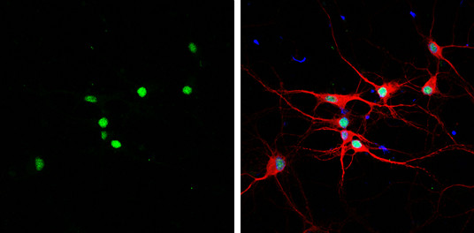 HMGB1 Antibody in Immunocytochemistry (ICC/IF)