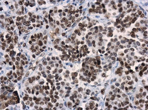 HMGB1 Antibody in Immunohistochemistry (Paraffin) (IHC (P))