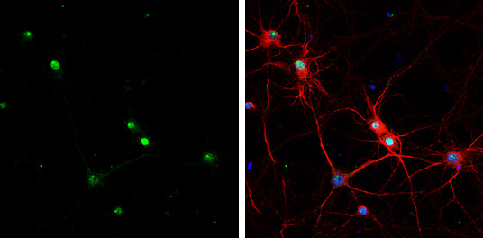 HMGB1 Antibody in Immunocytochemistry (ICC/IF)