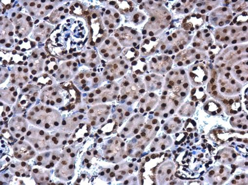 HMGB1 Antibody in Immunohistochemistry (Paraffin) (IHC (P))