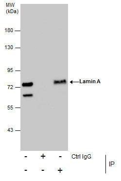 Lamin A/C Antibody in Immunoprecipitation (IP)