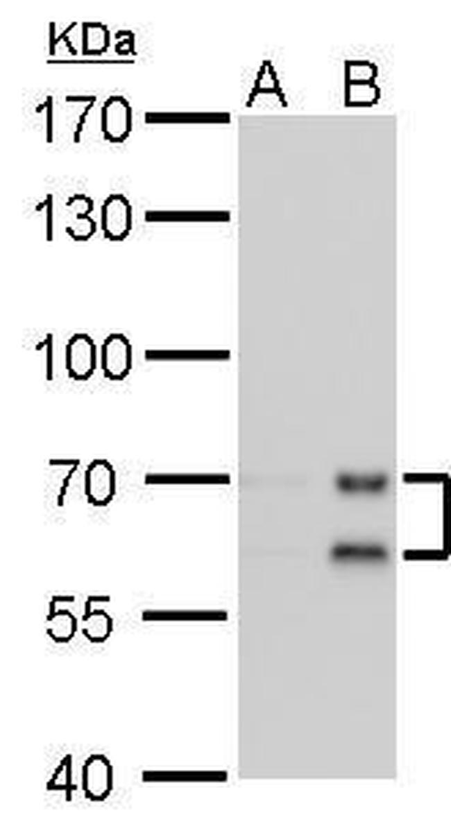 Lamin A/C Antibody in Western Blot (WB)