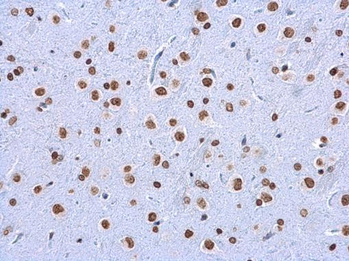 5-Methylcytosine Antibody in Immunohistochemistry (Paraffin) (IHC (P))