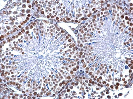 5-Methylcytosine Antibody in Immunohistochemistry (Paraffin) (IHC (P))