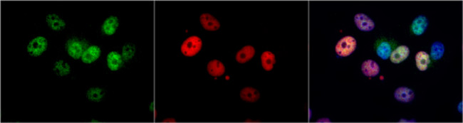 p21 Antibody in Immunocytochemistry (ICC/IF)