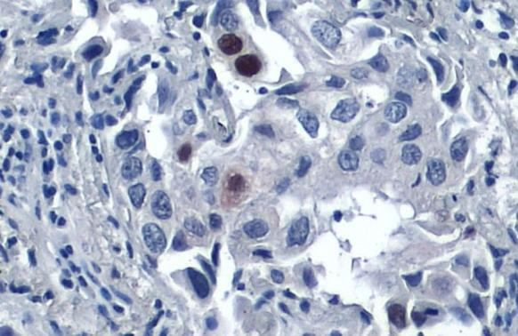 p21 Antibody in Immunohistochemistry (Paraffin) (IHC (P))