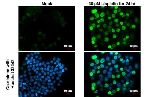 p21 Antibody in Immunocytochemistry (ICC/IF)