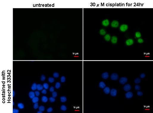 p21 Antibody in Immunocytochemistry (ICC/IF)