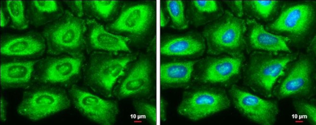 FASN Antibody in Immunocytochemistry (ICC/IF)