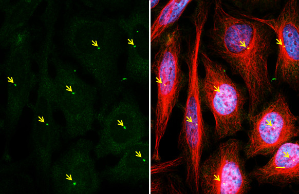 gamma Tubulin Antibody in Immunocytochemistry (ICC/IF)