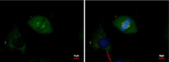 gamma Tubulin Antibody in Immunocytochemistry (ICC/IF)