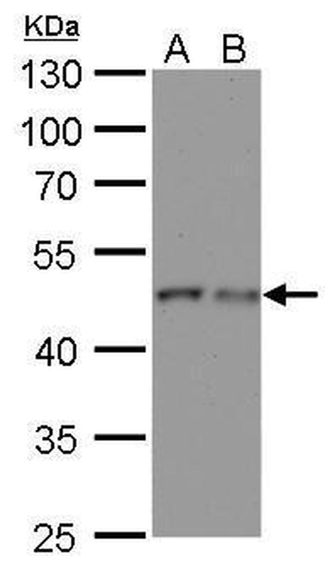 gamma Tubulin Antibody in Western Blot (WB)