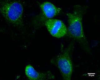 gamma Tubulin Antibody in Immunocytochemistry (ICC/IF)