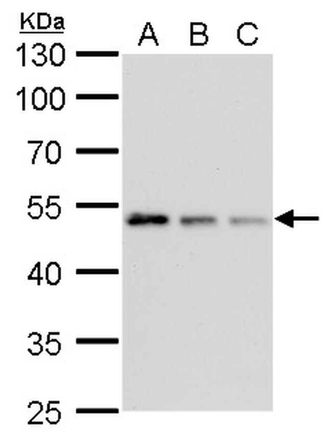 gamma Tubulin Antibody in Western Blot (WB)