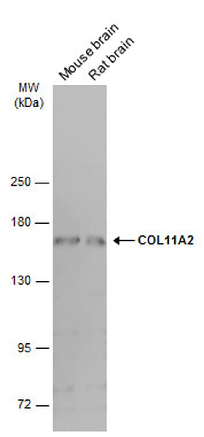 COL11A2 Antibody in Western Blot (WB)