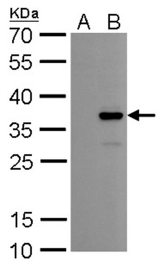 COL11A2 Antibody in Western Blot (WB)