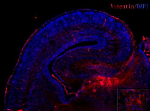 Vimentin Antibody in Immunohistochemistry (Frozen) (IHC (F))