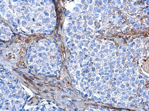 Vimentin Antibody in Immunohistochemistry (Paraffin) (IHC (P))