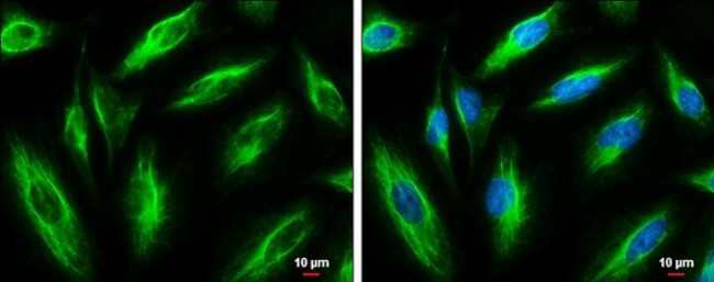 Vimentin Antibody in Immunocytochemistry (ICC/IF)