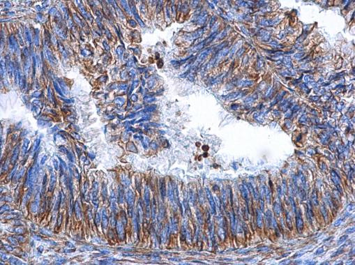 Vimentin Antibody in Immunohistochemistry (Paraffin) (IHC (P))