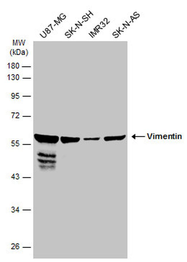 Vimentin Antibody in Western Blot (WB)