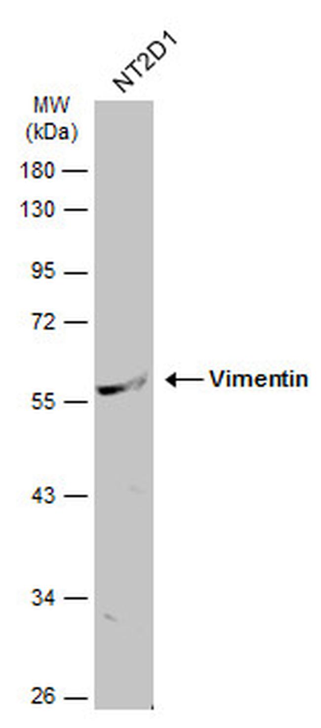 Vimentin Antibody in Western Blot (WB)