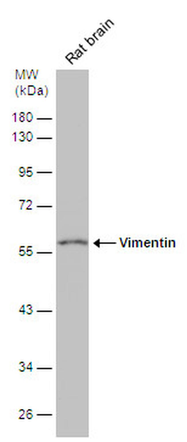 Vimentin Antibody in Western Blot (WB)