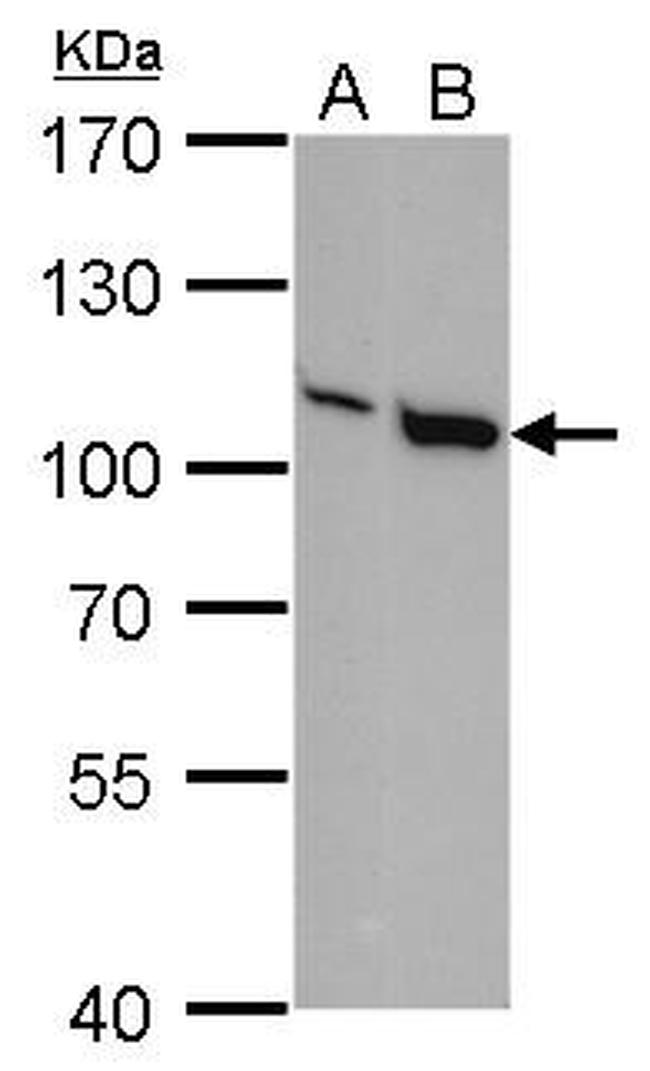 VAV1 Antibody in Western Blot (WB)