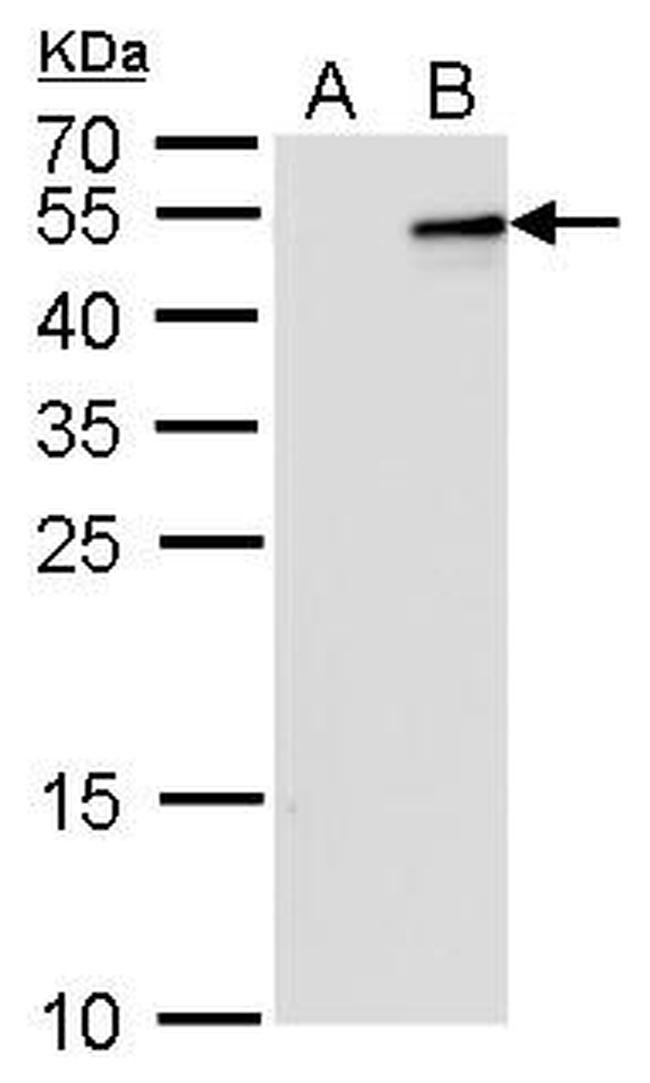 IL-28B Antibody in Western Blot (WB)